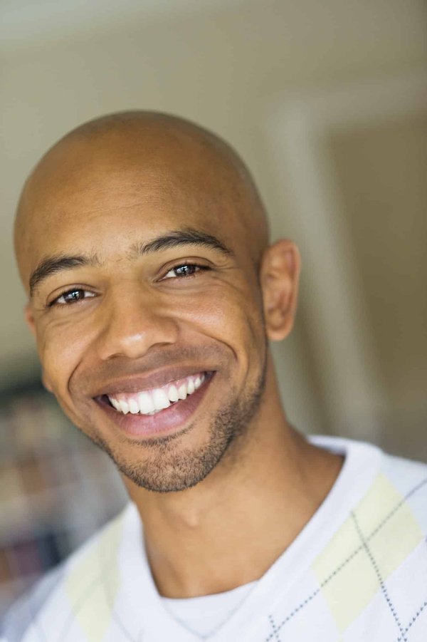 Calvitie chez l'homme jeune : quelles solutions possibles ?